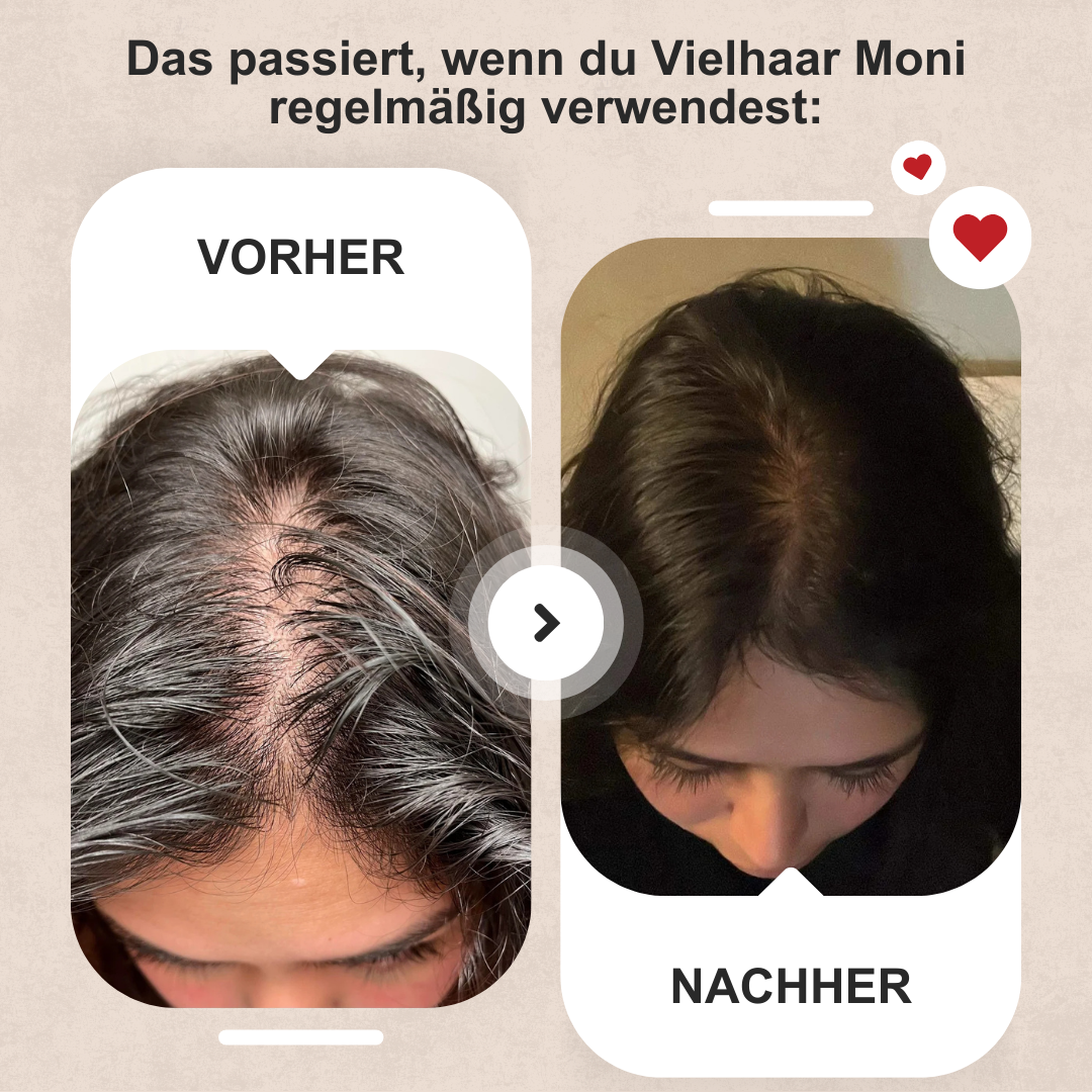 Vielhaar Moni Haarwuchs-Konzentrat – Bild 6
