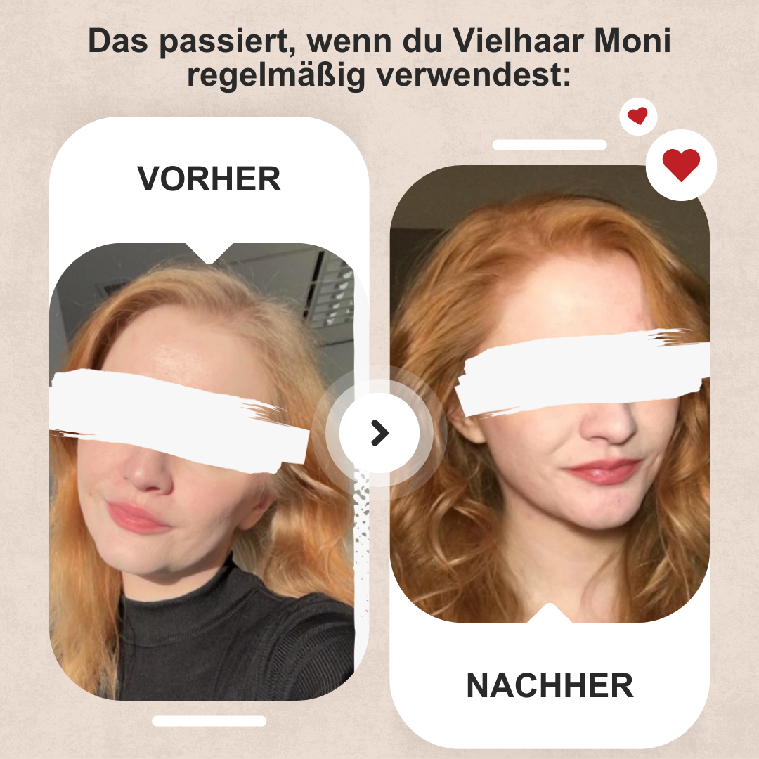 Vielhaar Moni Haarwuchs-Konzentrat – Bild 8