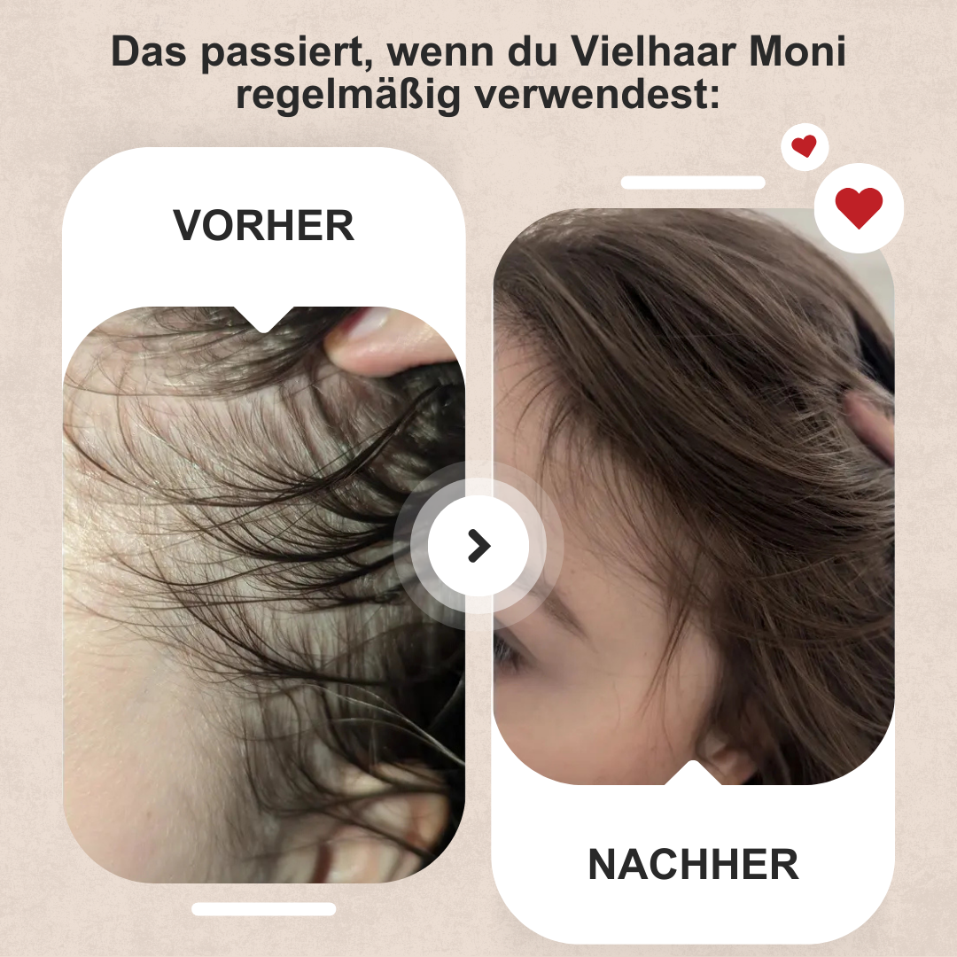 Vielhaar Moni Haarwuchs-Konzentrat – Bild 7