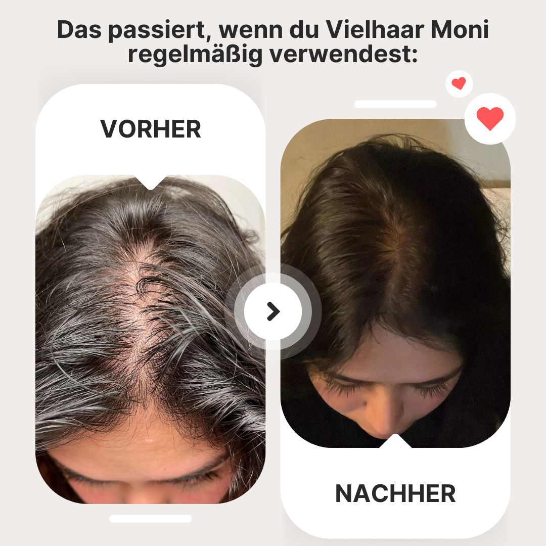 Vielhaar Moni Set – Bild 2